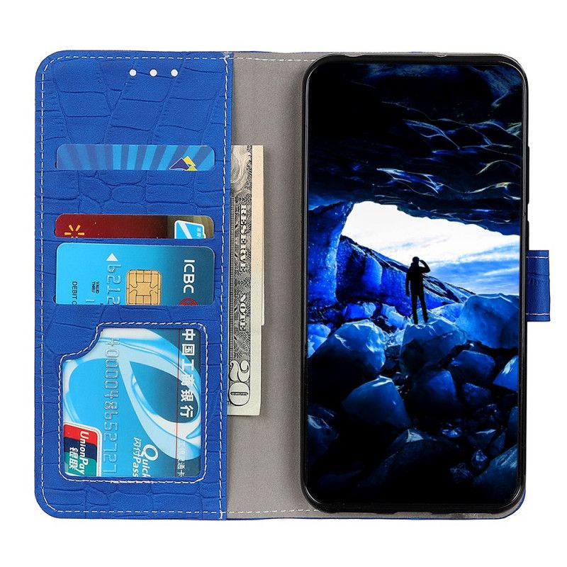 Flip Cover Xiaomi Redmi Note 11 / 11S Krokodillekraft